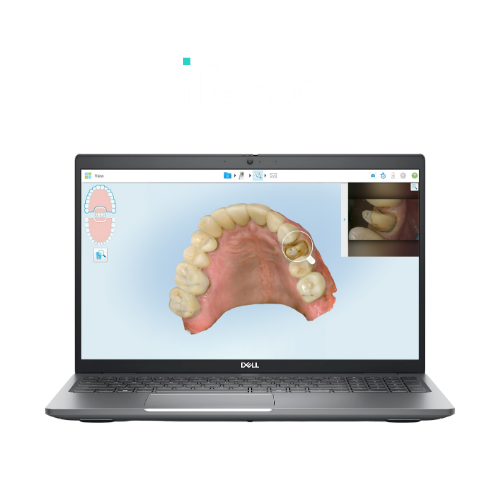 iTero Scanner