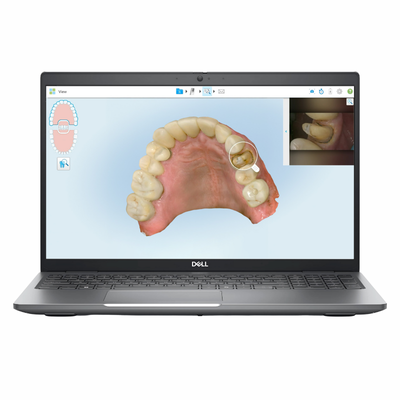 iTero - Dell Pro Max 16