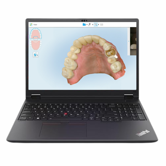 iTero - Lenovo ThinkPad P16v Gen 3