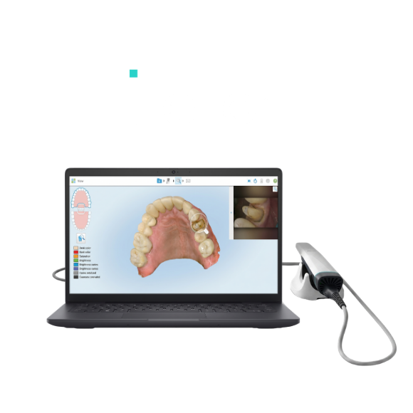 iTero Scanner