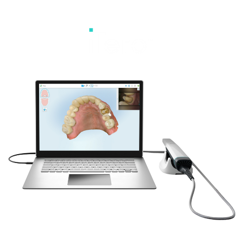 iTero Scanner